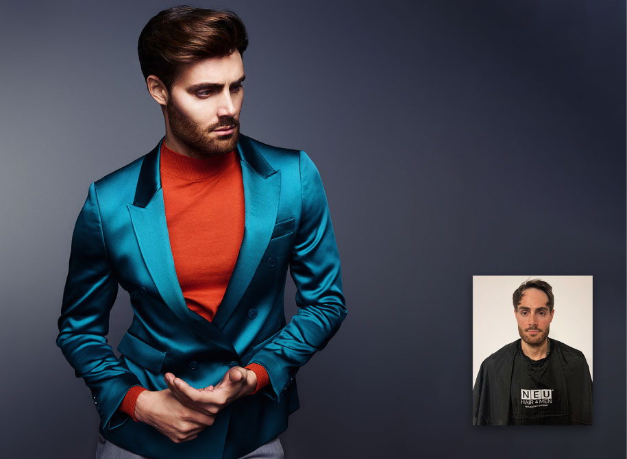 Male Hair Replacement Systems in Somerset
